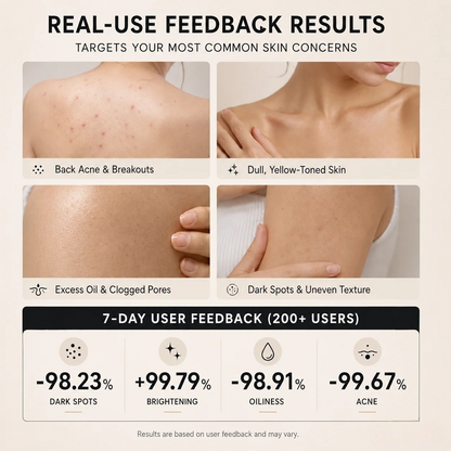 Niacinamide Skin Brightening Soap melasma dark spots freckle